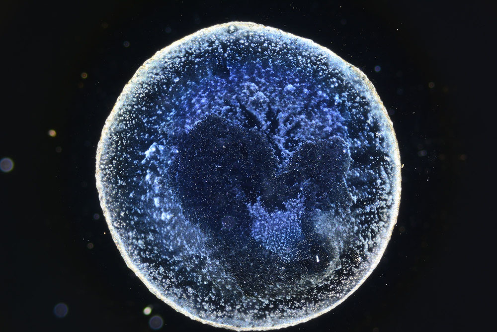 Dunkelfeldmikroskop Wasserbild nach Stimmgabel Behandlung